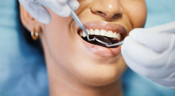 Best Emergency Care for Gum Disease in China Grove, NC